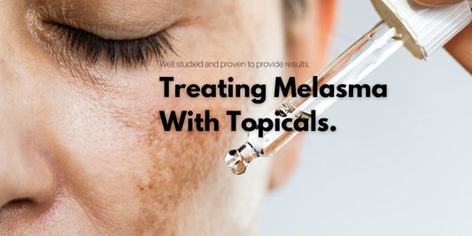 Treating Melasma with Topicals: Your Guide to Clearer Skin.