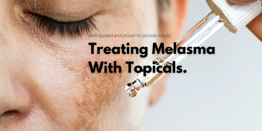 Treating Melasma with Topicals: Your Guide to Clearer Skin